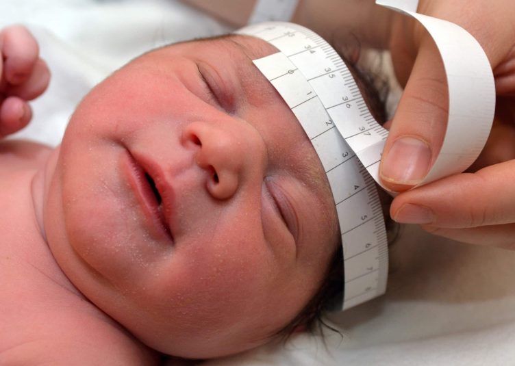 baby's head measured by a tape measurer